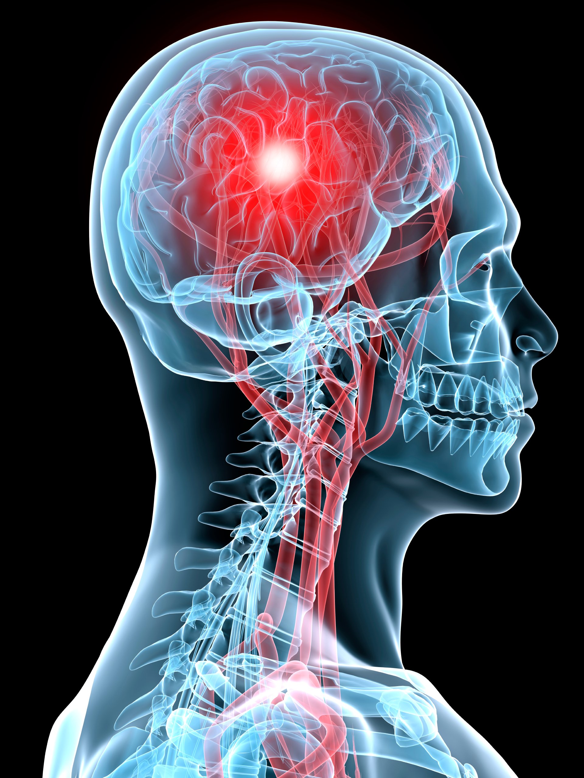 concussion cover photo
